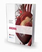 Angina