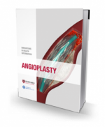Angioplasty