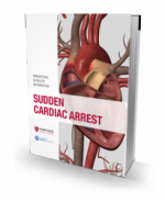Sudden Cardiac Arrest