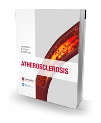 Atherosclerosis